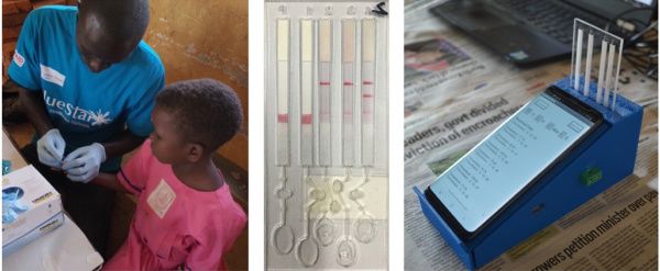 (Left) an individual having a blood sample taken which will be analysed; (middle), the sample-to-answer multiplexed cartridge involving a paper-based microfluidic test, enabling DNA based species-specific detection at the point-of-need and (right) the use of a mobile phone-controlled platform (with the cartridge inserted), enabling computing with a cloud-based decision support tool to record the result.