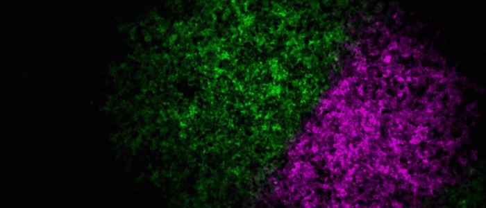 Microscopy imaging of two strains of flu represented by green and purple fluorescence showing the segregation between the two strains in the host cell.